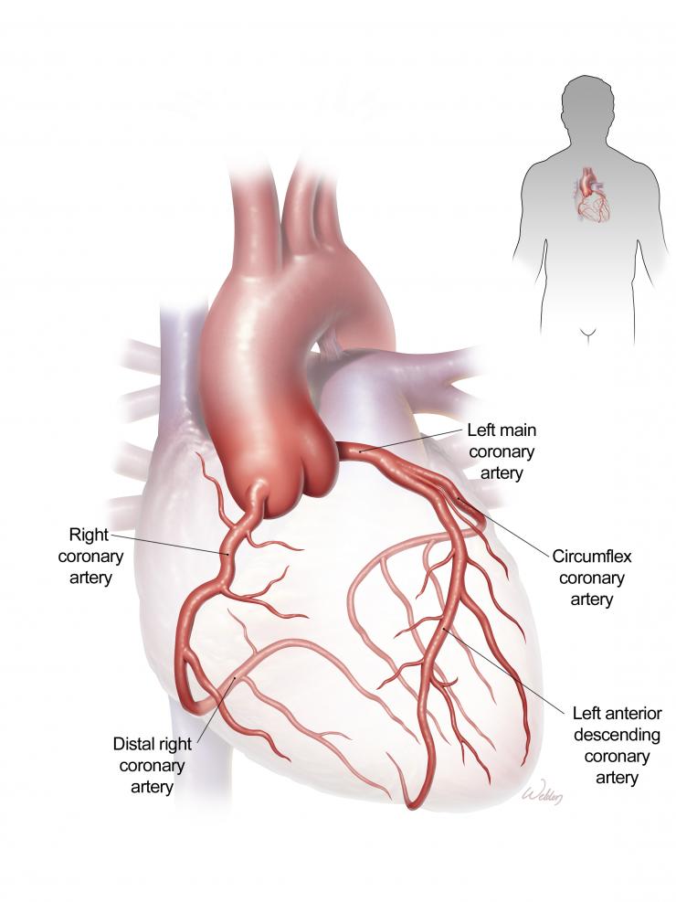 Cardiac vessel anatomy (credit: Scott Weldon)