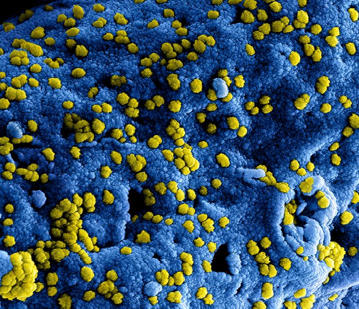 Colorized scanning electron micrograph of Middle Eastern Respiratory Syndrome virus particles (yellow) attached to the surface of an infected cell (blue)