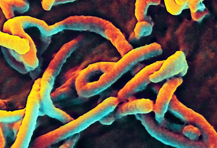 Scanning electron micrograph of Ebola virus budding from the surface of a  monkey cell line