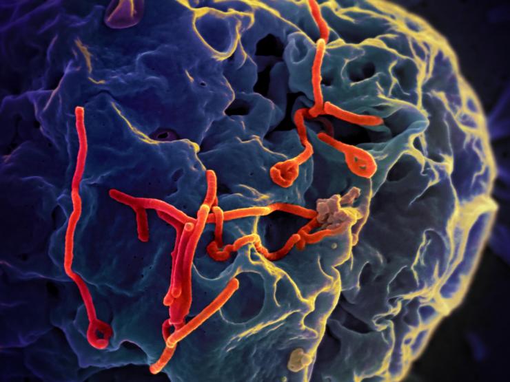 Ebola virus particles budding from a monkey cell