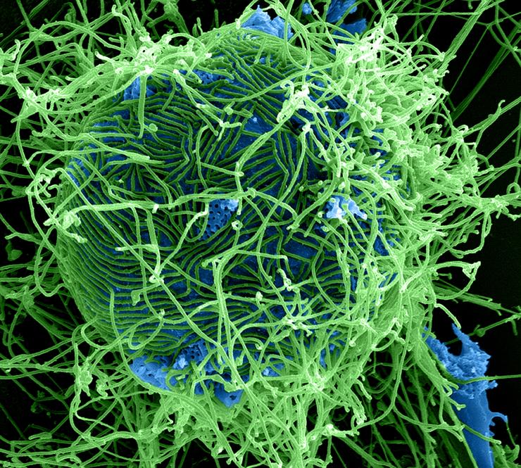 Colorized scanning electron micrograph of filamentous Ebola virus particles (green) attached to and budding from an infected cell (blue) (25,000x magnification).