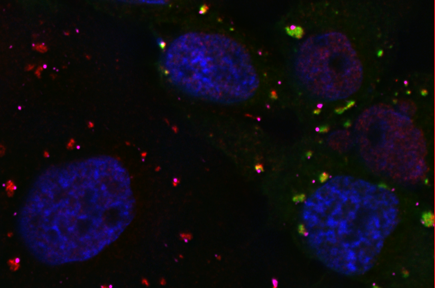 Stress Granule Assembly Stress Granule Assembly