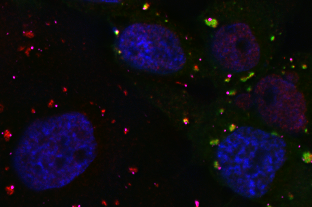 Stress Granule Assembly