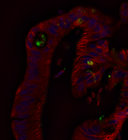 Enterovirus Replication in Beta Cell Models and Intestinal Enteroids Enterovirus Replication in Beta Cell Models and Intestinal Enteroids