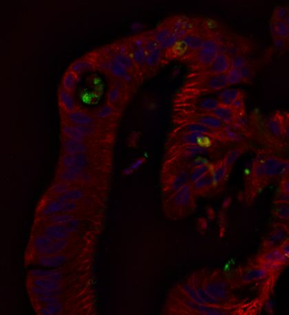 Enterovirus Replication in Beta Cell Models and Intestinal Enteroids