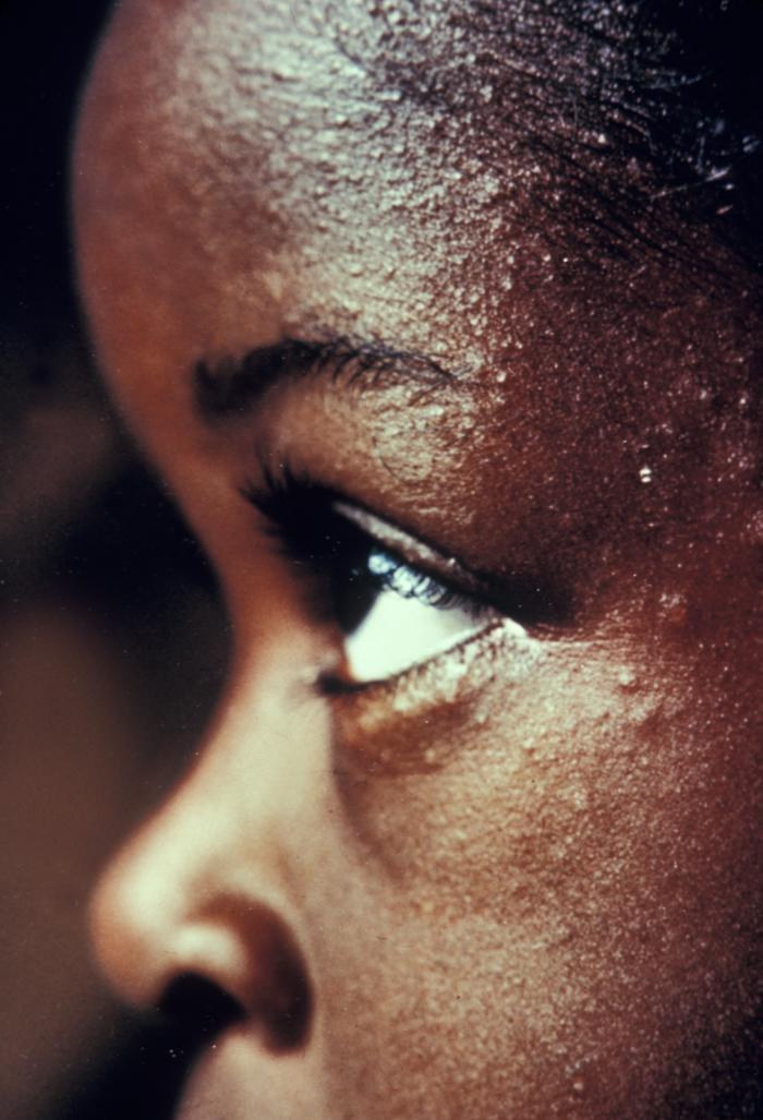 African American Child's Eyes African American Child's Eyes