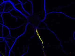 Rat hippocampal neuron triple labeled for MAP2 (blue), ?IV spectrin (green), and Neurofascin-186 (red).)
