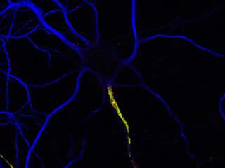 aisintro Rat hippocampal neuron triple labeled for MAP2 (blue), ?IV spectrin (green), and Neurofascin-186 (red).)