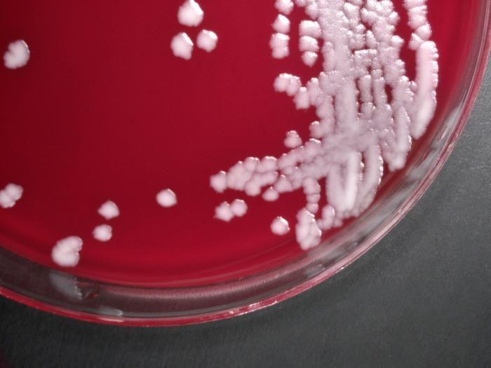 Colonies of the anthrax bacterium Bacillus anthracis growing in a culture dish
