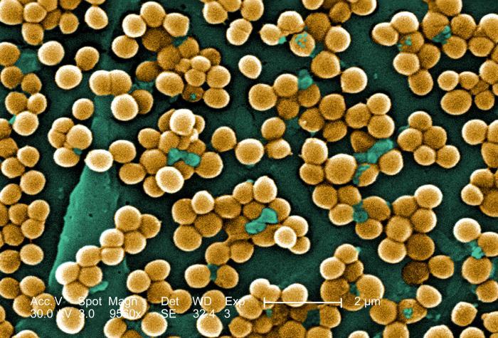 Scanning electron micrograph image depicting numerous clumps of methicillin-resistant Staphylococcus aureus bacteria; Magnified 9560x.
