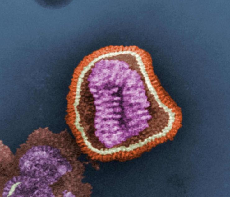 Stained transmission electron micrograph showing the ultrastructural details of an influenza virus particle.