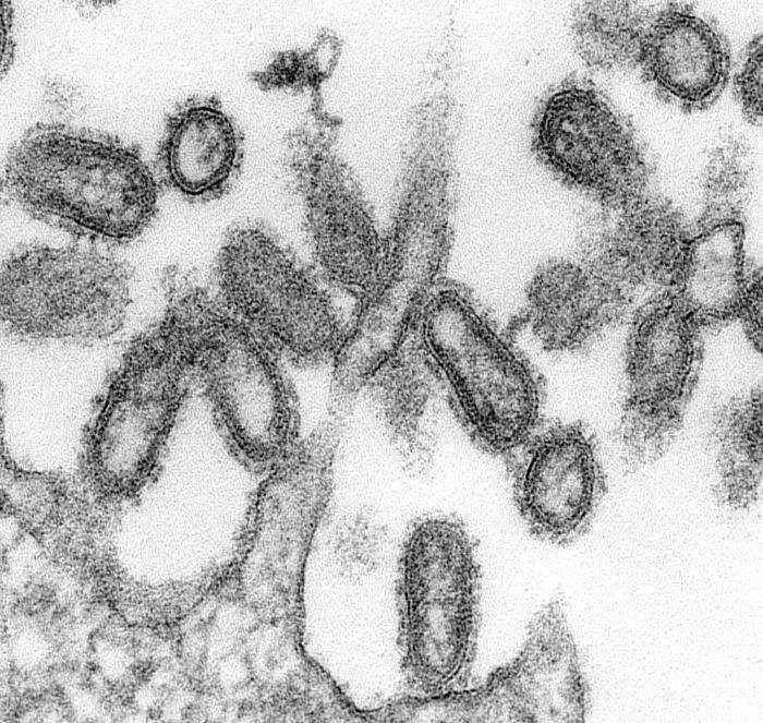 Electron Micrograph of 1918 Flu particles