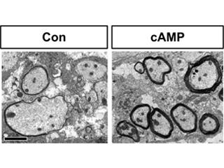 CNS Injury and Repair needs caption