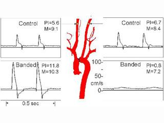 Effects of transverse aortic banding on carotid blood flow patterns in mice