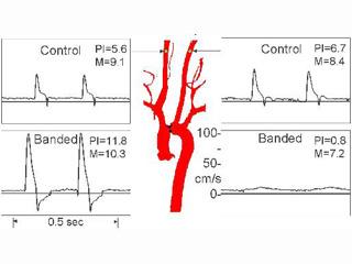 Effects of Transverse Aortic Banding on Carotid Blood Flow Patterns in Mice Effects of transverse aortic banding on carotid blood flow patterns in mice