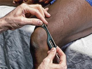 Graston Technique The Graston Technique® uses a stainless steel instrument that glides along a patient’s muscle, tendons or ligaments to detect where scar tissue or restrictions are located.