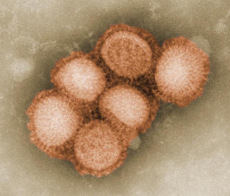 Influenza A H1N1 Swine Flu