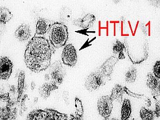 Human T-lymphotropic Virus