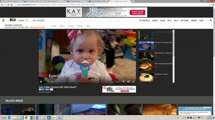 The Animal Planet channel features a story on congenital CMV infection.