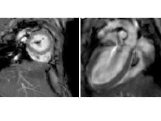 MRI images of mouse hearts.