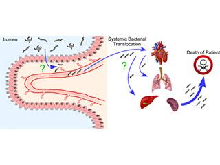 The translocation of pathogenic pathobionts from the intestinal lumen to the systemic circulation.