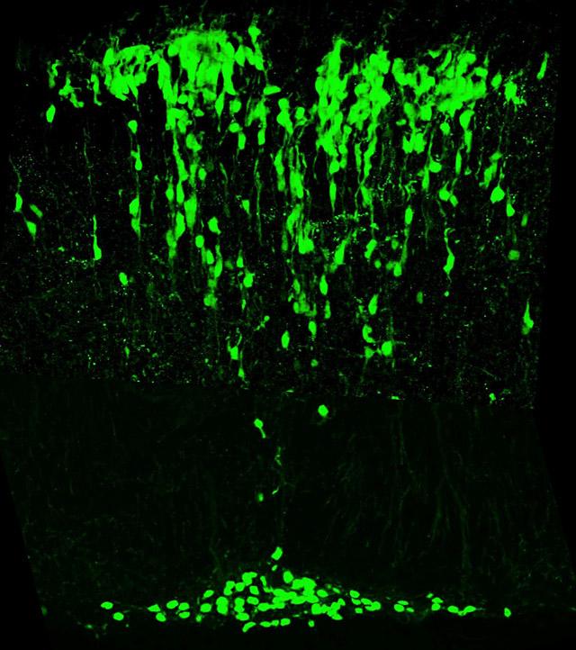 Math1 stands for mouse atonal homolog 1, and is also known as Atoh1. Atoh1 governs the functional development of the parafacial respiratory group/retrotrapezoid nucleus neurons are is essential for the genesis of a wide range of cell types.