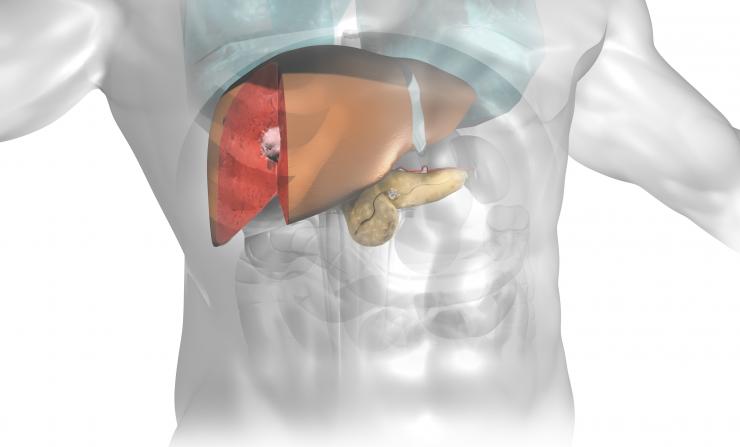 Liver and Pancreas tumors