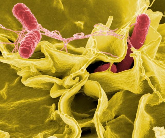 Salmonella bacteria, a common cause of foodborne disease, invade an immune cell.