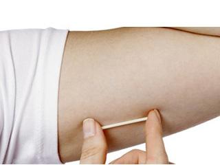 The implantable contraceptive is a thin, match-sized rod implant placed on inner side of woman’s upper arm.