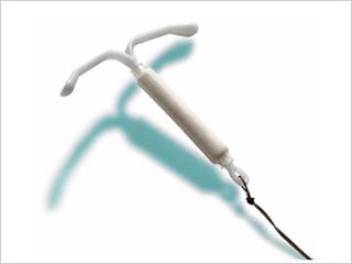 An IUD is a small T-shaped implant placed in the uterus by your healthcare provider.