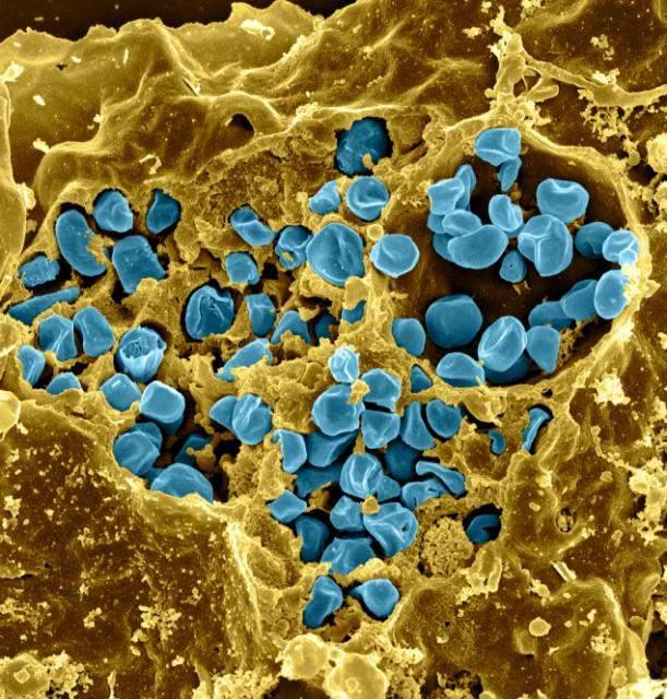 Scanning electron micrograph of a murine macrophage infected with Francisella tularensis strain LVS. Bacteria are colorized in blue.