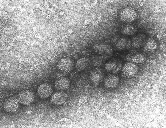 Electron micrograph of the West Nile virus
