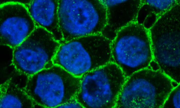 Human breast epithelial cells 