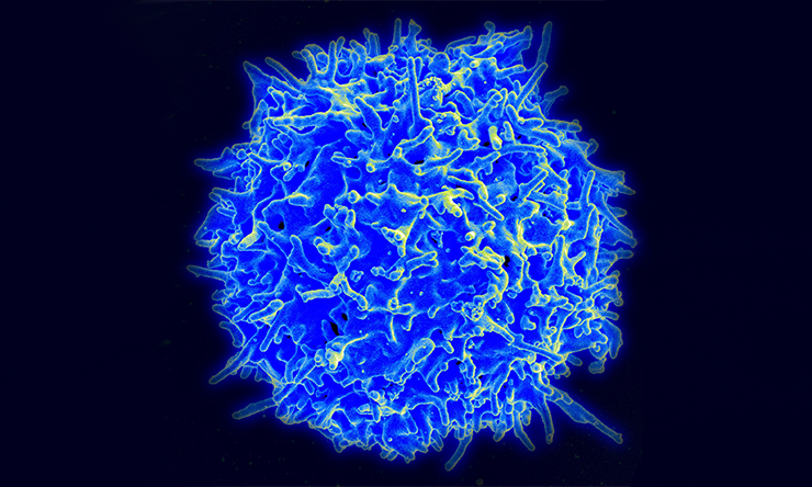An electron micrograph of a human T cell.