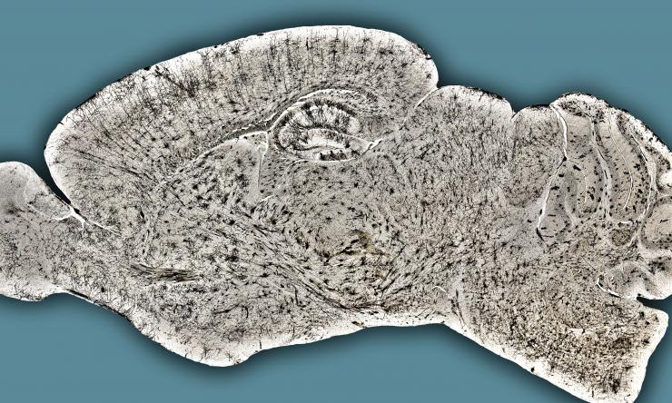 Golgi staining of a mouse brain 