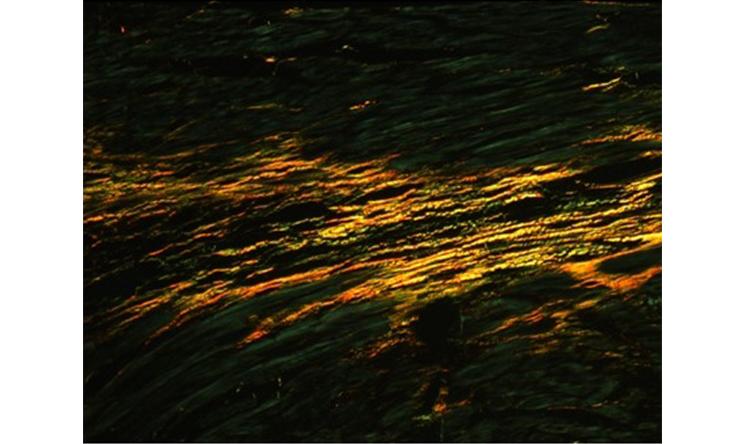 Collagen structure in the mouse heart evaluated by the picrosirius red staining under a polarized light.