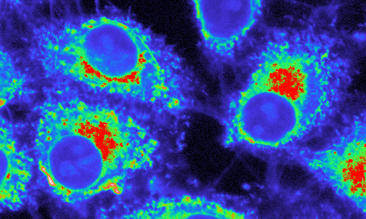 Microscopy image of  lysomone cells