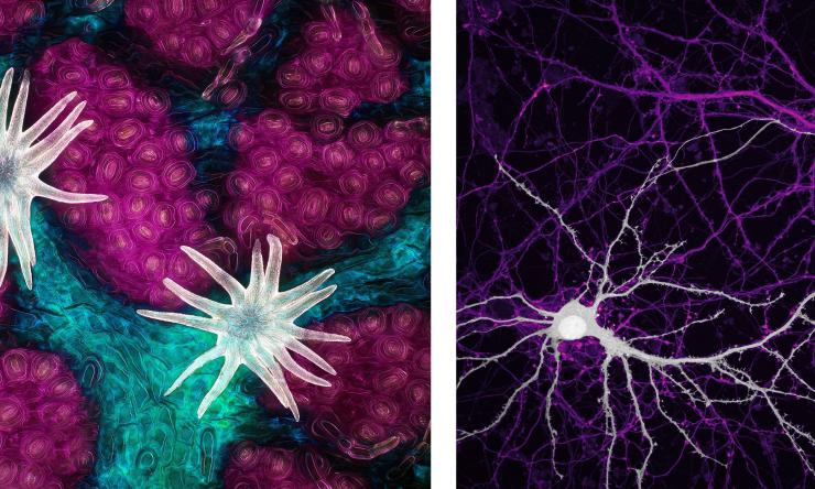 Microscopy Images: (Left) Oak Leaf Surface, (Right) Mouse Brain Neurons