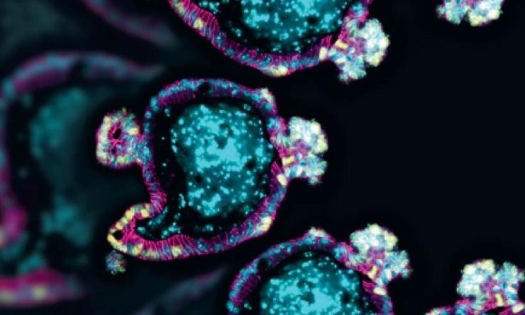 Mouse intestinal organoids showing proliferating cells in yellow, cell adhesion markers in pink and cell nuclei in blue