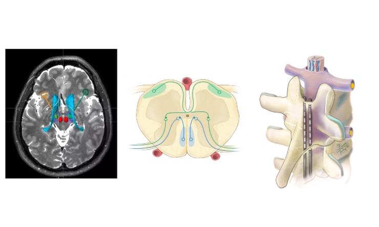 Neuromodulation Lab homepage updated image