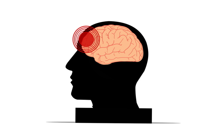 A drawing of a brain with a red dot indicating an injury or pain. 