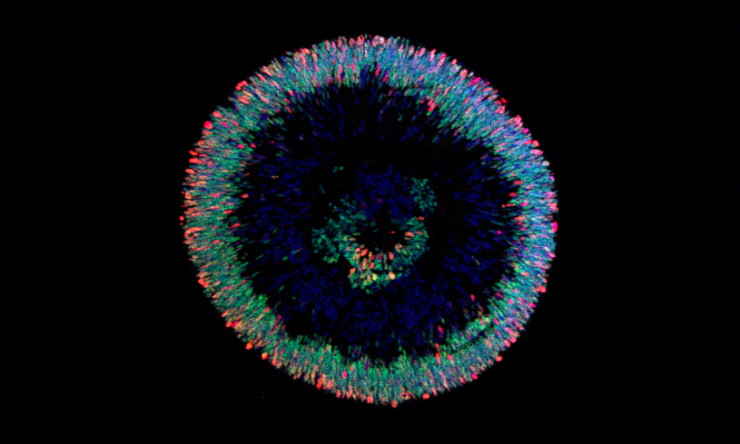 Cell nuclei shown in blue, green shows cells with an early retinal marker and red labels mark dividing cells.