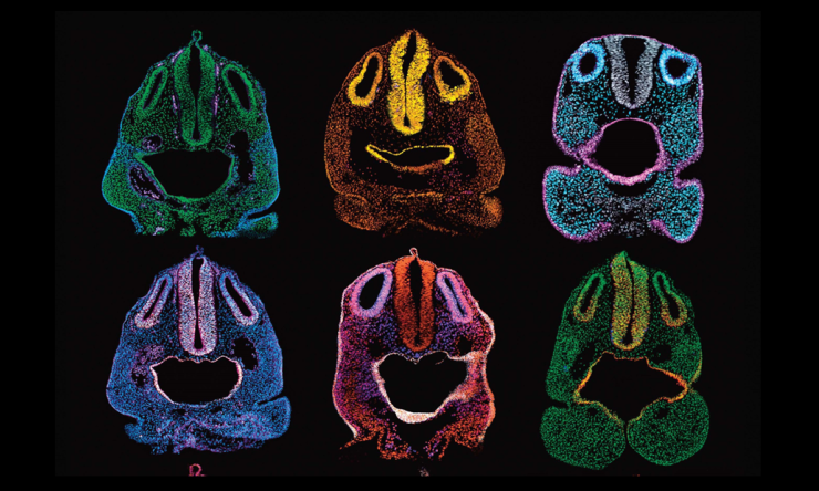 Six multicolored microscopic images resembling human faces 