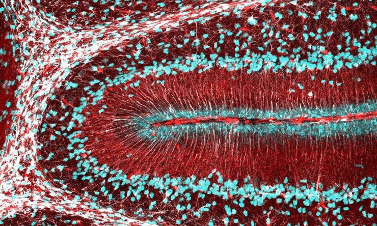 confocal image