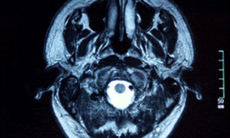 scan of a human brain