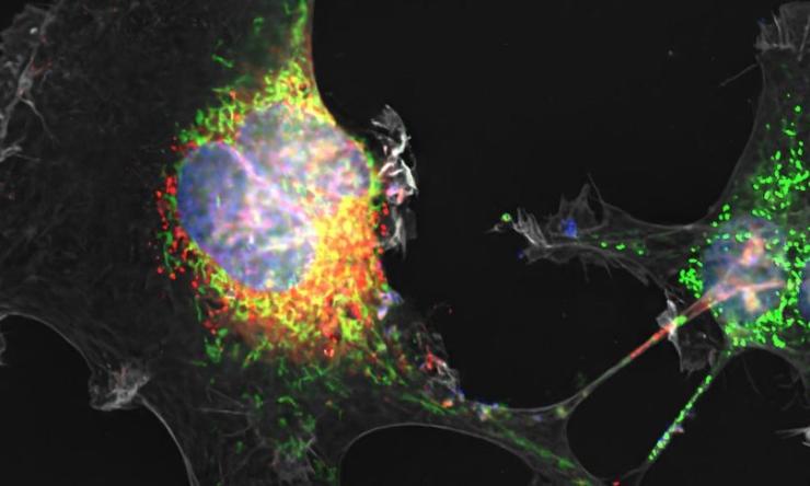 A microscopic image showing a strand of colored dots leading from one green-tinted cell to a yellow-tinted cell..