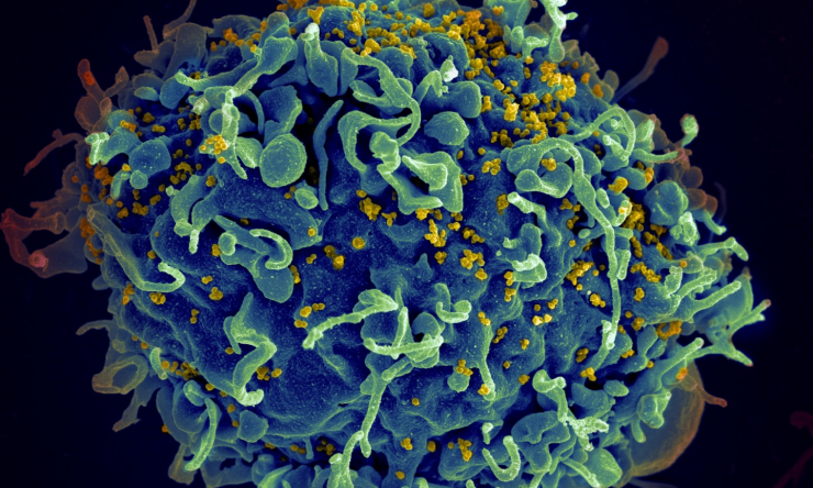 HIV, the AIDS virus (yellow), infecting a human cell