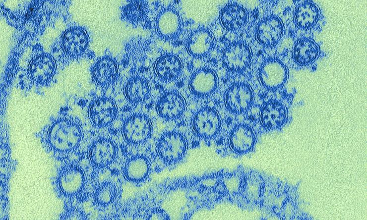 This highly-magnified, digitally-colorized transmission electron micrograph (TEM) depicted numbers of virions from a Novel Flu H1N1 isolate