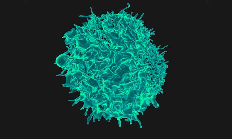 This is a colorized scanning electron micrograph of a T lymphocyte, a type of immune cell that can be 'trained' to fight cancer.