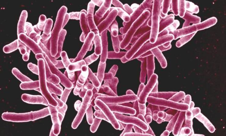 Scanning electron micrograph of Mycobacterium tuberculosis bacteria, which cause TB.